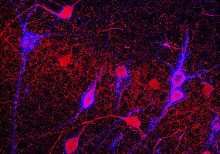 Neuronas inhibidoras (en rojo) envueltas por redes perineuronales (en azul). Autor Juan Nácher.